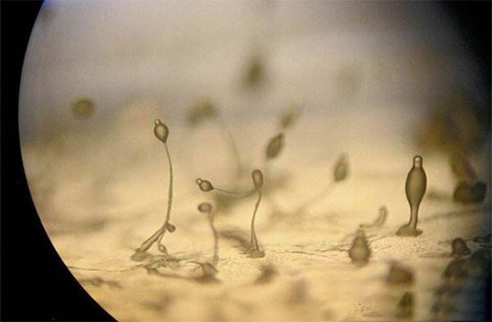 危害最大的四種黴菌毒素