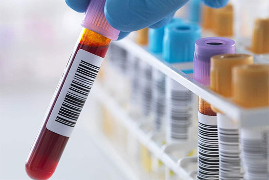 嚴防非洲豬瘟,農業部豬料禁用血漿等制品,該用什麼呢?